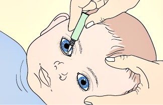 Как правильно закапывать глаза ребенку