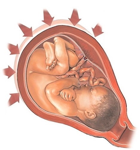 Причины гипертонуса матки при беременности