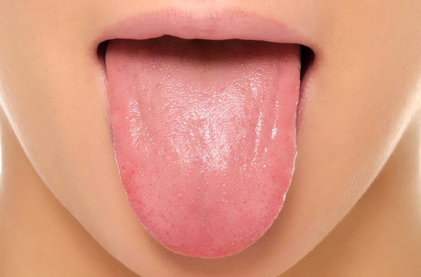 Чому на язиці білий наліт - причини обкладеності язика у дітей і дорослих