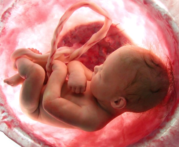 Причини внутрішньоутробної інфекції у новонароджених, при вагітності, симптоми, лікування, наслідки